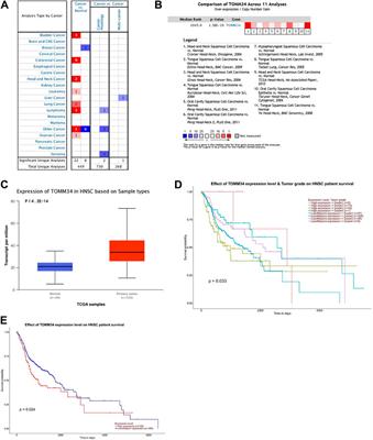 High Expression of Tomm34 and Its Correlations With Clinicopathology in Oral Squamous Cell Carcinoma